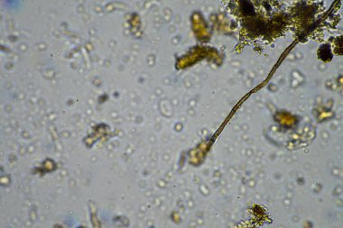 İlkbaharda toprak örneğinde mikroskobik orman mantarı hyphae 'si