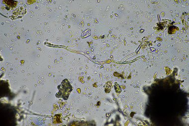 Mikroskop altındaki orman toprağı örneği doğadaki mikroorganizmalara ve mantarlara bakıyor.