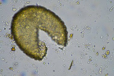 İlkbaharda toprak örneğinde mikroskobik orman mantarı hyphae 'si