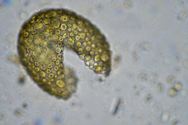 İlkbaharda toprak örneğinde mikroskobik orman mantarı hyphae 'si