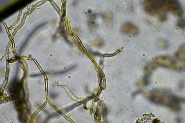 İlkbaharda toprak örneğinde mikroskobik orman mantarı hyphae 'si