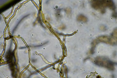 mikroorganizmalar ve toprak biyolojisi, mikroskop altında nematodlar ve mantarlar. Toprakta ve gübrelerde 