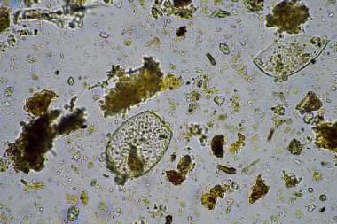 Mikroskop altındaki orman toprağı örneği doğadaki mikroorganizmalara ve mantarlara bakıyor.