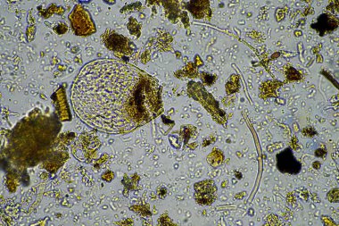 Mikroskop altındaki orman toprağı örneği doğadaki mikroorganizmalara ve mantarlara bakıyor.