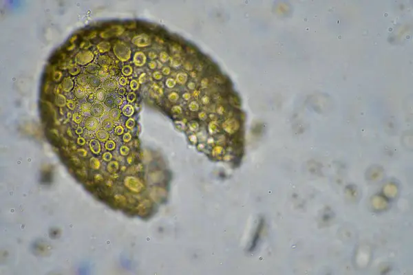 stock image soil sample containing soil biology, with bacteria, fungi, amoeba, flagellate, and arcella, on a sustainable agricultural farm in australia 