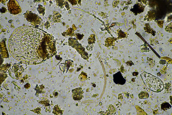 microorganisms and soil biology, with nematodes and fungi under the microscope. in a soil and compost