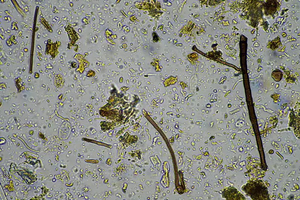 soil sample containing soil biology, with bacteria, fungi, amoeba, flagellate, and arcella, on a sustainable agricultural farm in australia