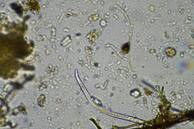 mikroorganizmalar ve toprak biyolojisi, mikroskop altında nematodlar ve mantarlar. Toprakta ve gübrelerde 