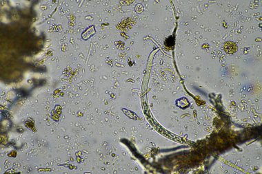 Avustralya 'da sürdürülebilir bir tarım çiftliğinde bakteri, mantar, amip, kırbaç ve arcella içeren toprak örneği. 