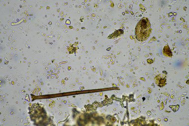 Mikroskop altındaki orman toprağı örneği doğadaki mikroorganizmalara ve mantarlara bakıyor.