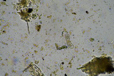 mikroskop altında toprak mikropları. gübre içinde mantarlı mikroorganizmalar