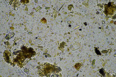 Mikroskop altında mikroskobik mikroorganizmalar