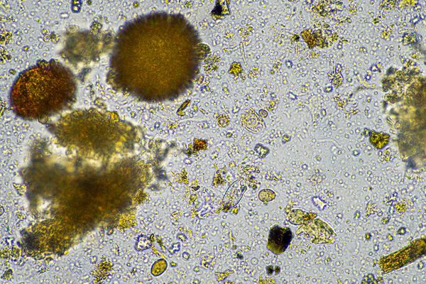 почвенные микробы под микроскопом. микроорганизмы с грибком в компосте