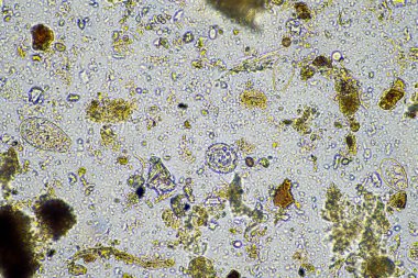 Avusturalya 'daki bir örnekte mikroskobik mantar ve mikroorganizmalar