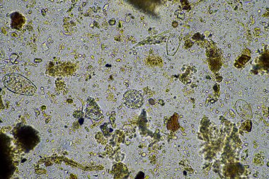 mikroskop altında toprak mikropları. gübre içinde mantarlı mikroorganizmalar