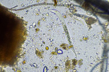 Avusturalya 'daki bir örnekte mikroskobik mantar ve mikroorganizmalar