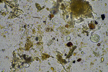 mikroskop altında toprak mikropları. gübre içinde mantarlı mikroorganizmalar