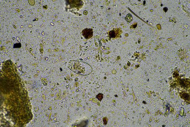Kompost içindeki mikroorganizmalar ve biyoloji ve mikroskop altındaki toprak örnekleri 