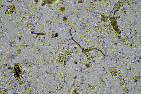 microscopic fungus and microorganisms in a sample in australia