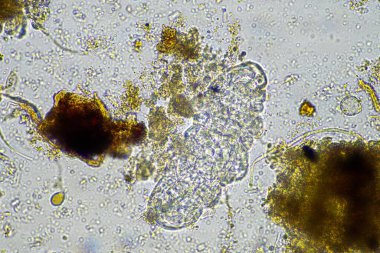 bir çiftlikteki toprak örneğinde mikroorganizmalar ve tardigradlar 