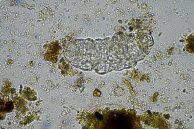 microorganisms and a tardigrade in a soil sample on a farm  clipart