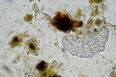 bir çiftlikteki toprak örneğinde mikroorganizmalar ve tardigradlar 