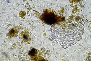 bir çiftlikteki toprak örneğinde mikroorganizmalar ve tardigradlar 