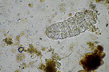 bir çiftlikteki toprak örneğinde mikroorganizmalar ve tardigradlar 