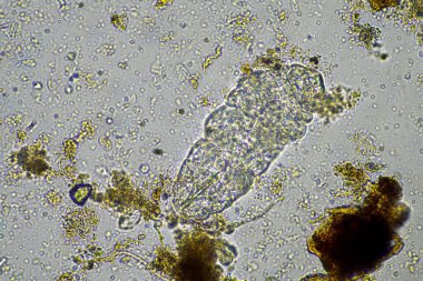 bir çiftlikteki toprak örneğinde mikroorganizmalar ve tardigradlar 