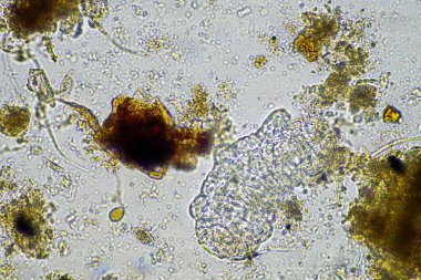 bir çiftlikteki toprak örneğinde mikroorganizmalar ve tardigradlar 