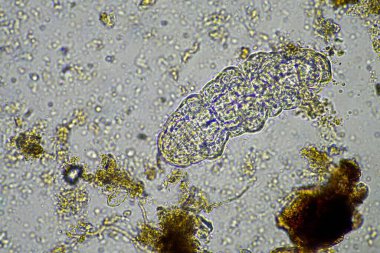 bir çiftlikteki toprak örneğinde mikroorganizmalar ve tardigradlar 