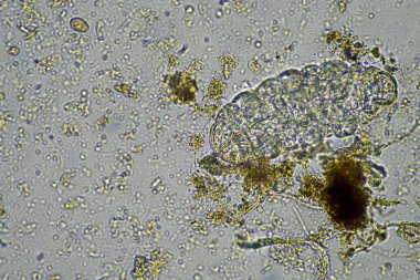 bir çiftlikteki toprak örneğinde mikroorganizmalar ve tardigradlar 