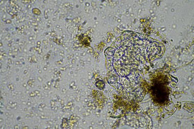 bir çiftlikteki toprak örneğinde mikroorganizmalar ve tardigradlar 