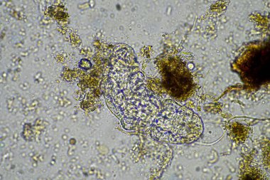 bir çiftlikteki toprak örneğinde mikroorganizmalar ve tardigradlar 