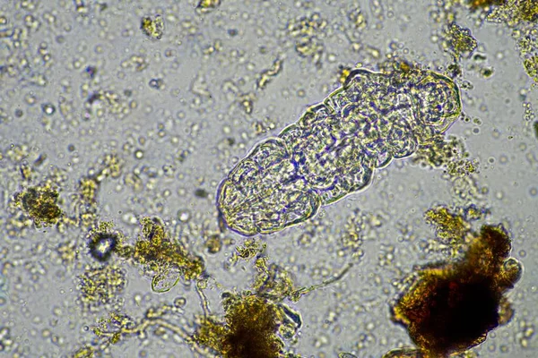microorganisms and a tardigrade in a soil sample on a farm