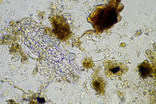 microorganisms and a tardigrade in a soil sample on a farm