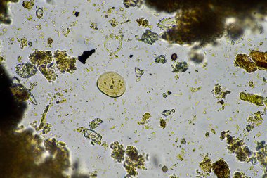 soil microorganism under the microscope recycling nutrients in a compost on a regenerative agriculture farm in australia, showing amoeba, fungi, fungal, microbes and nematodes in spring clipart