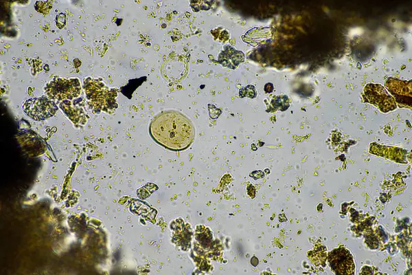 Bodenmikroorganismen Unter Dem Mikroskop Beim Recycling Von Nährstoffen Einem Kompost Stockbild