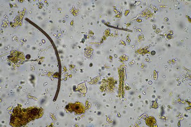 Avustralya 'da rejeneratif tarım çiftliğindeki gübrelerde besin geri dönüşümü mikroskop altında toprak mikroorganizması, ilkbaharda amip, mantar, mantar, mikrop ve nematodları gösteriyor.