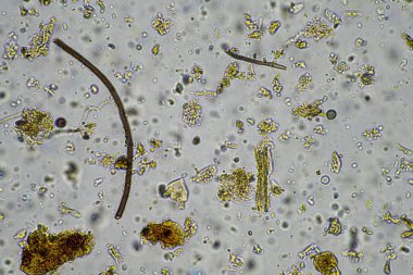 Avustralya 'da rejeneratif tarım çiftliğindeki gübrelerde besin geri dönüşümü mikroskop altında toprak mikroorganizması, ilkbaharda amip, mantar, mantar, mikrop ve nematodları gösteriyor.