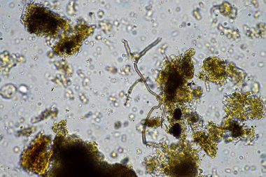 Avustralya 'da rejeneratif tarım çiftliğindeki gübrelerde besin geri dönüşümü mikroskop altında toprak mikroorganizması, ilkbaharda amip, mantar, mantar, mikrop ve nematodları gösteriyor.