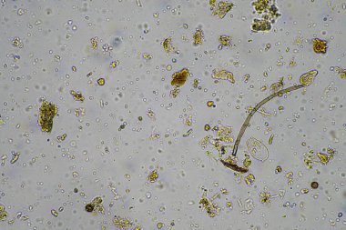 Avustralya 'da rejeneratif tarım çiftliğindeki gübrelerde besin geri dönüşümü mikroskop altında toprak mikroorganizması, ilkbaharda amip, mantar, mantar, mikrop ve nematodları gösteriyor.