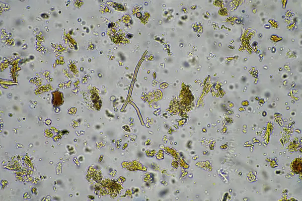 soil microorganism under the microscope recycling nutrients in a compost on a regenerative agriculture farm in australia, showing amoeba, fungi, fungal, microbes and nematodes in spring