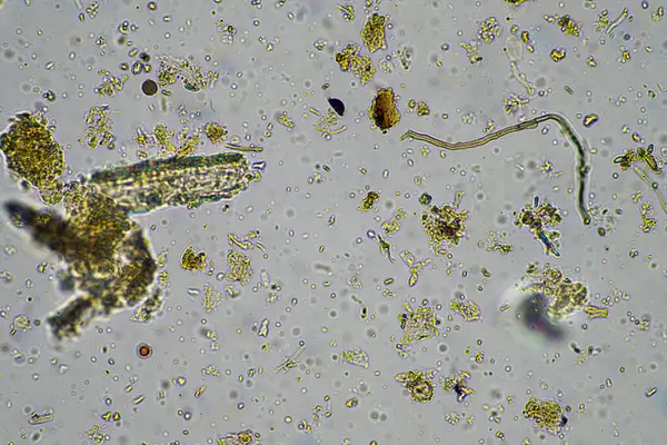 soil microorganism under the microscope recycling nutrients in a compost on a regenerative agriculture farm in australia, showing amoeba, fungi, fungal, microbes and nematodes in spring