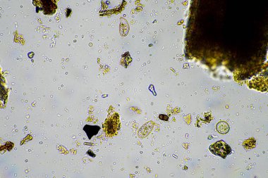 toprak yaşam örneğindeki toprak mikroorganizmaları sürdürülebilir bir tarım çiftliğinden. Avustralya 'da yaşayan yiyecek ağı veya bakteri mantarları ve protozoa