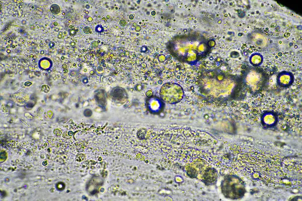 Grüner Schleim Und Husten Unter Dem Mikroskop Beim Anblick Von — Stockfoto