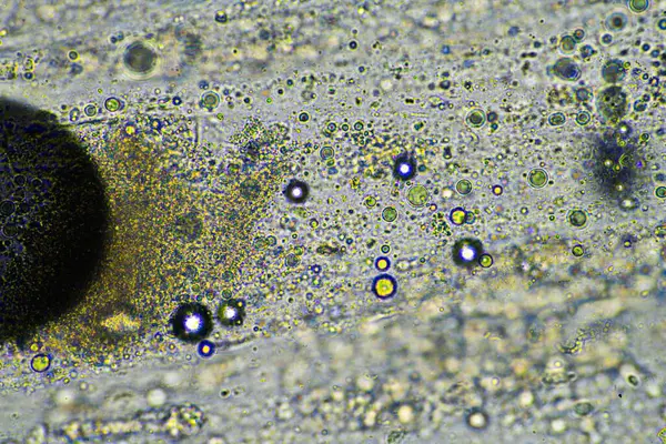 Зеленая Слизь Кашель Мокроты Микроскопом Глядя Клетки Гриппа Холодные Сопли — стоковое фото