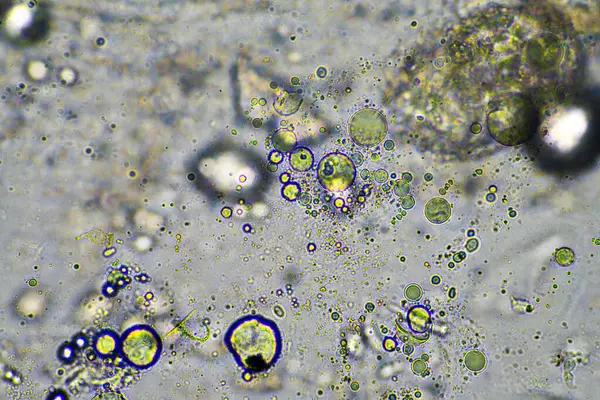 Zielony Śluzu Kaszel Flegmy Pod Mikroskopem Patrząc Komórki Grypy Zimne — Zdjęcie stockowe