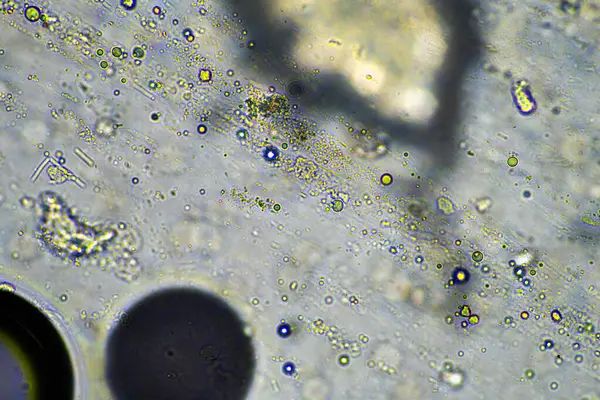 Кашель Слизи Мокроты Инфекции Грудной Клетки Вируса Бактерий Глядя Микроскопом — стоковое фото