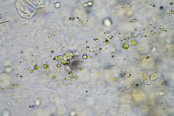 Moco Verde Tos Con Flema Bajo Microscopio Mirando Las Células — Foto de Stock
